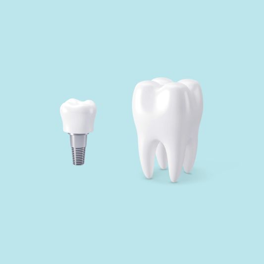 임플란트 치아와 치아 사진