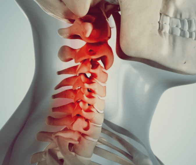 목뼈를-상해하게-보여주는-해부도