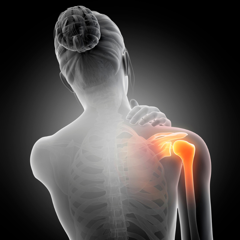 회전근개 파열 증상