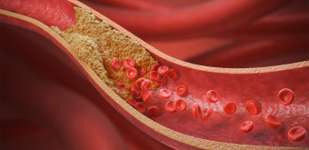 콜레스테롤 완전 정복