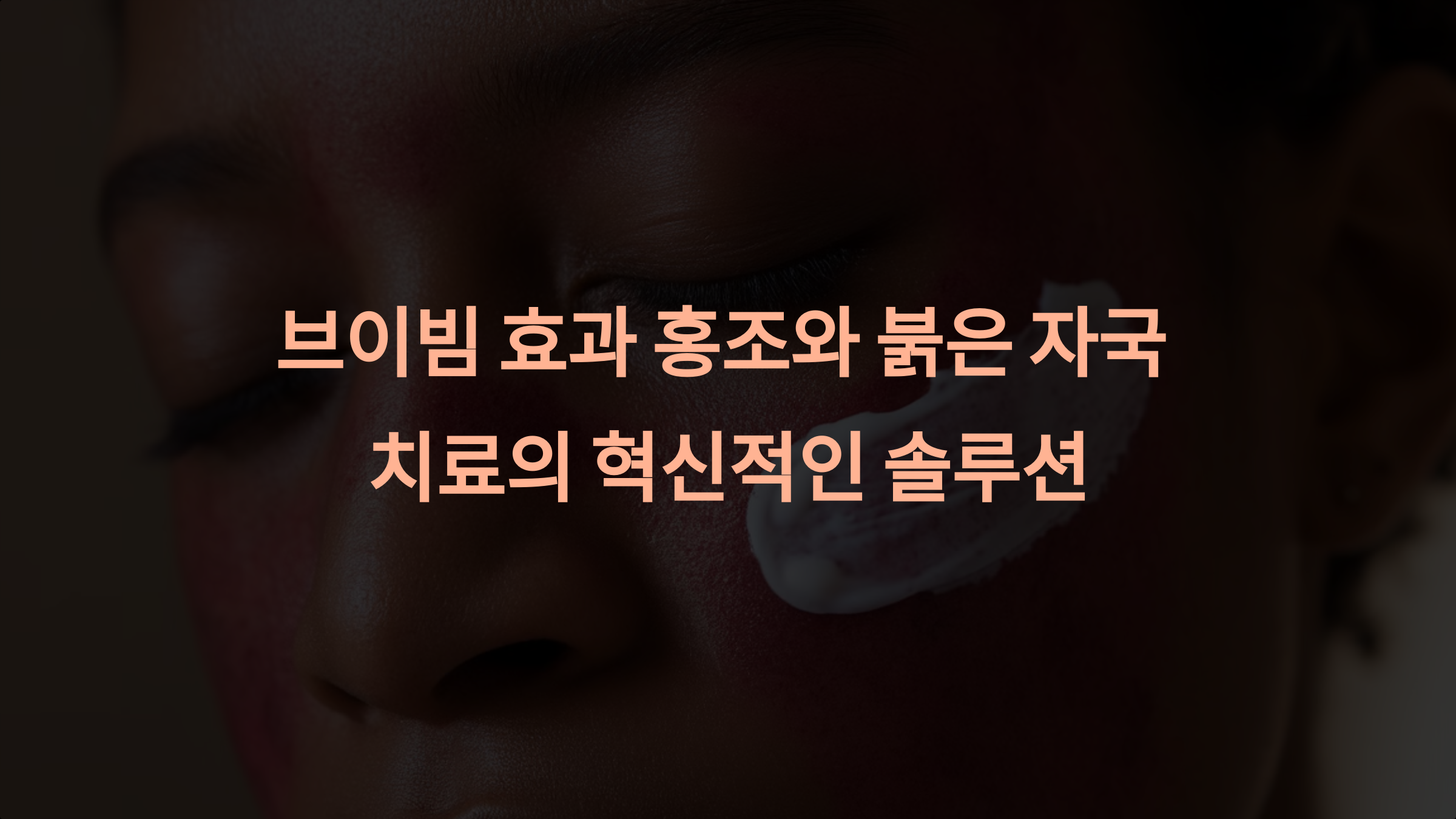 브이빔 효과: 홍조와 붉은 자국 치료의 혁신적인 솔루션