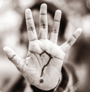 손가락 마디 통증 원인과 치료방법|언제 병원에 가야 할까?