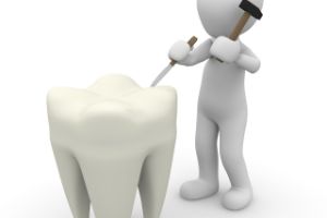 용인시-수지구-임플란트-치과-가격-비용-싼-곳,저렴한-곳,잘하는-곳,유명한-곳-BEST20-추천13