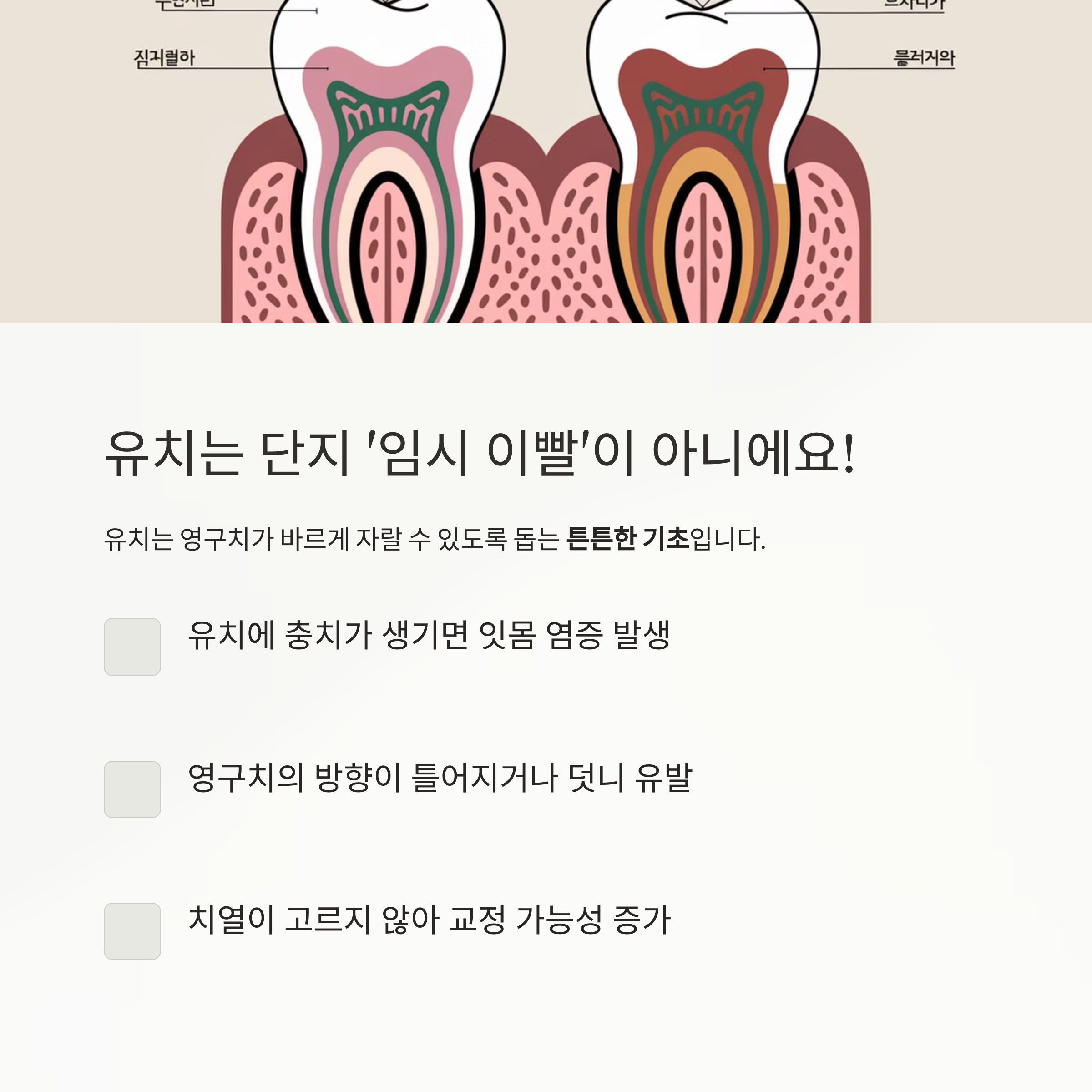 유치 건강 – 유치와 영구치의 연결 구조 및 충치 발생 시 문제점 설명