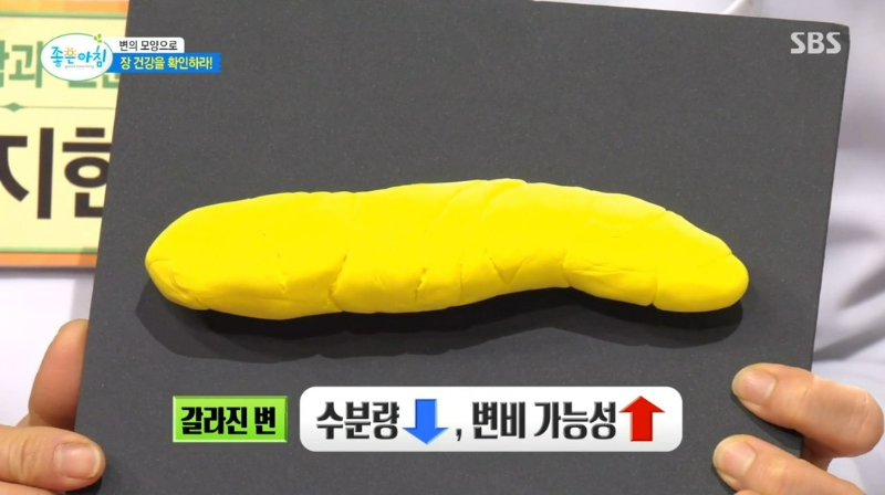 변비 증상 자가 진단 테스트
