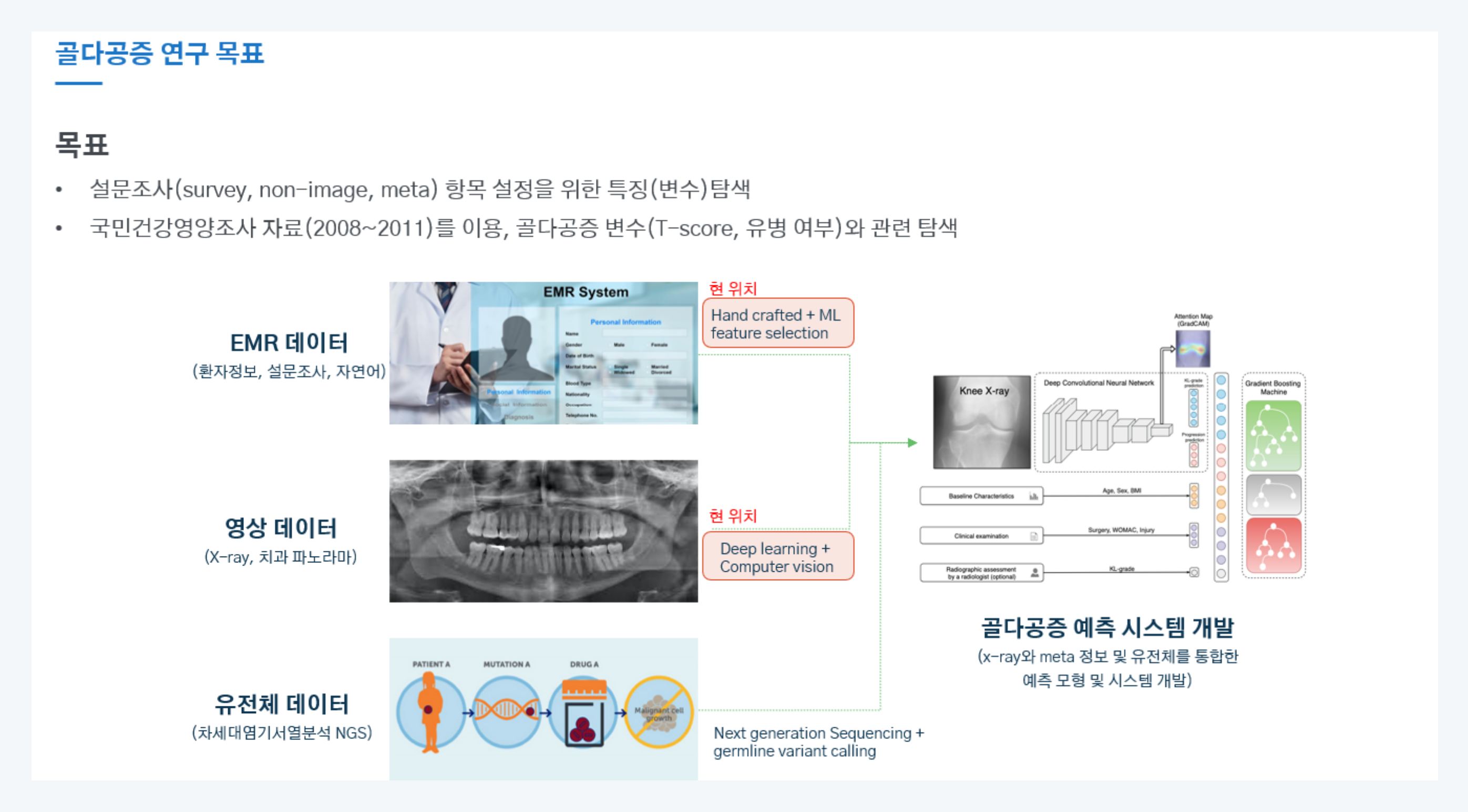 골다공증