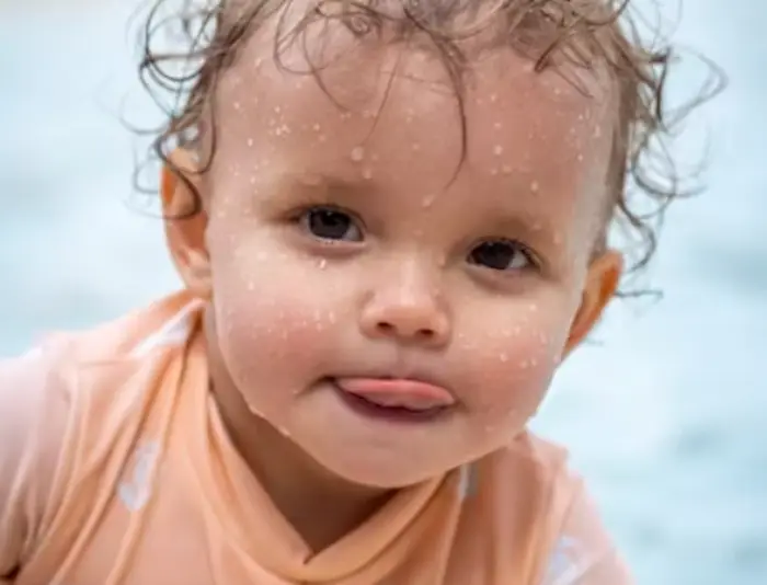 혓바늘 없애는 법