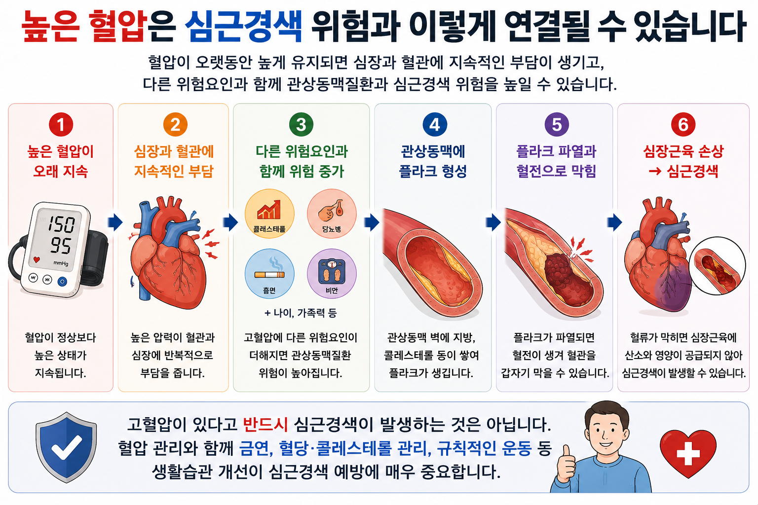 앞 그림과 유사하게 혈압&middot;플라크&middot;혈전과 심근경색의 관계를 설명한 개념 그림