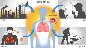 호흡기 질환: 폐기종- 원인, 증상, 치료방법, 진행단계, 진행속도 조절방법.