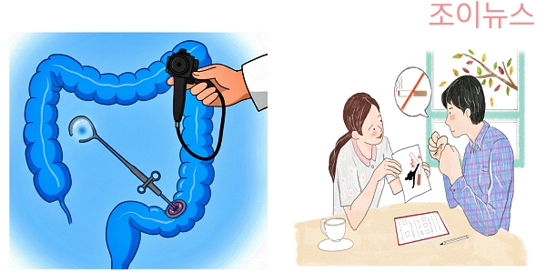 대장내시경 검사 당일