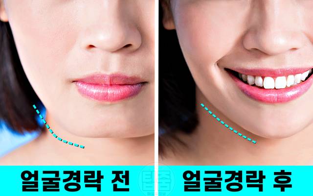 얼굴 작아지는법 경락 마사지 v라인 되는법