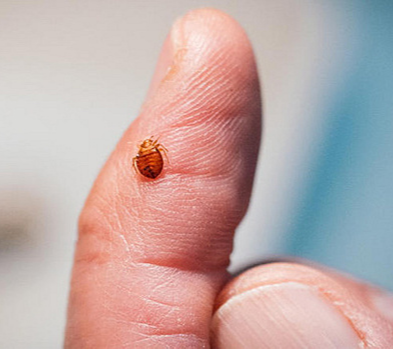 손가락 위에 있는 빈대