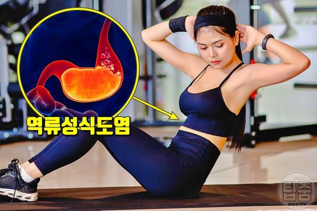 역류성식도염 증상 자연치료 방법 6가지