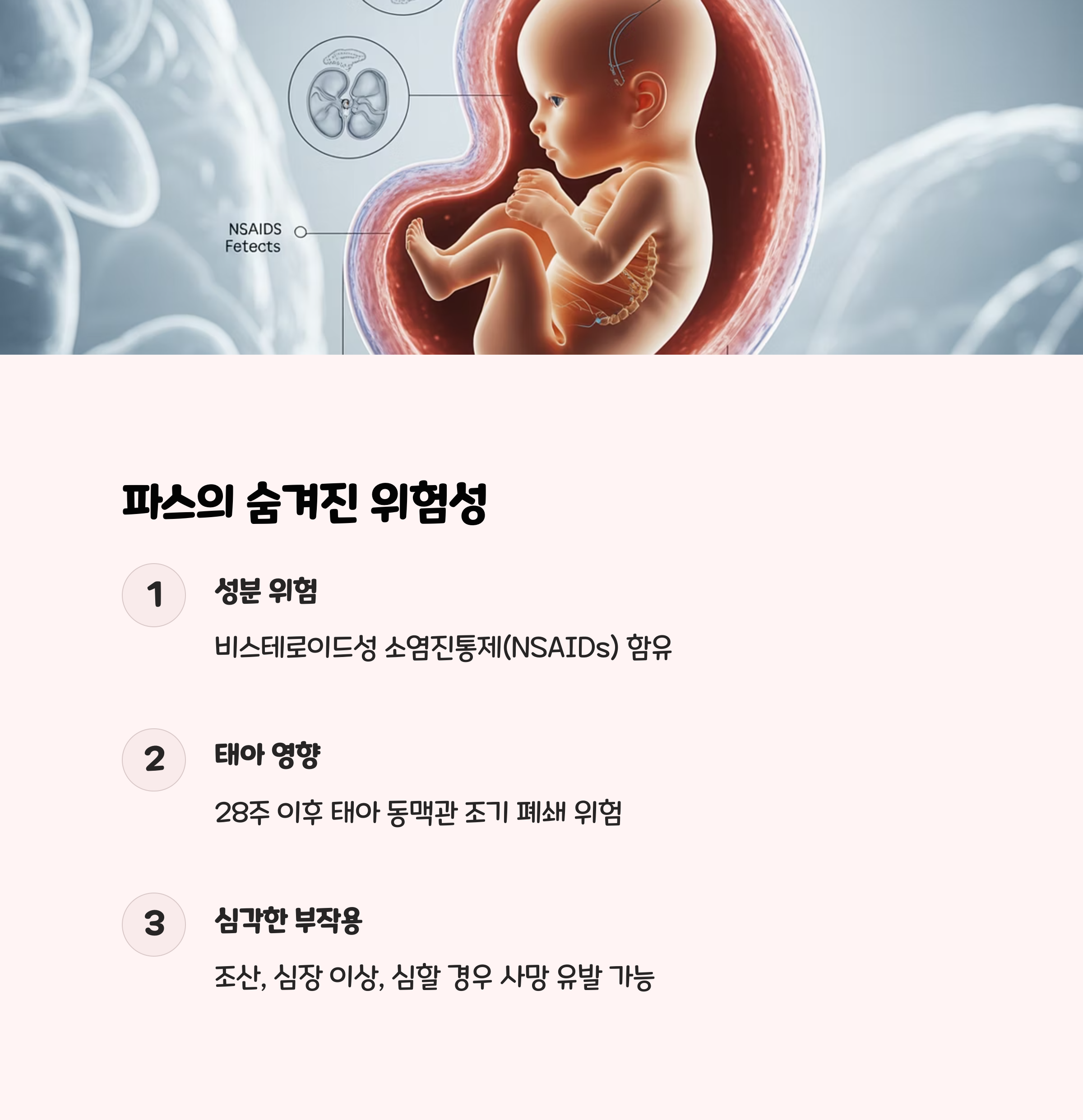 태아와 자궁 구조 일러스트와 함께 파스 성분의 위험성과 임신 후기 태아에게 미치는 영향, 부작용을 설명한 인포그래픽