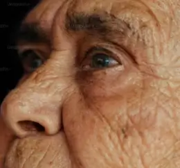 검버섯 레이저 치료 비용