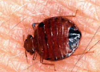 빈대-물린-자국