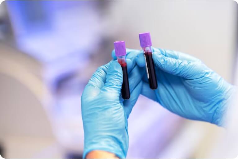 피 검사통을 살펴보는 간호사