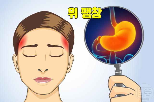 위가 부은 느낌 위가 붓는 이유 스트레스