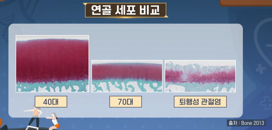 콘드로이친 효능