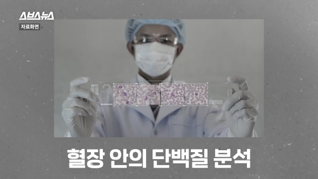 30대 후반 여성 급노화, 얼굴 주름살, 피부관리, 자기관리, 건강 뷰티 팁줌 매일꿀정보