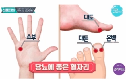 손과 발에 있는 수지침 혈자리 위치