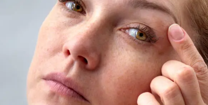 눈다래끼 예방 손으로 눈만지는중