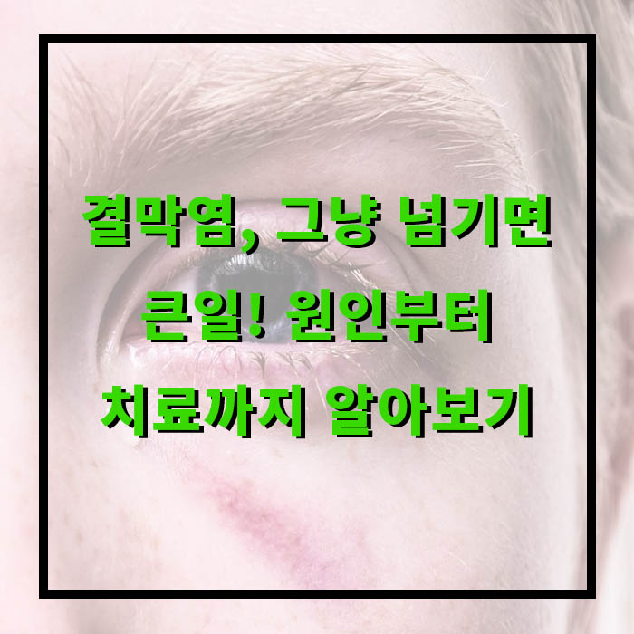 결막염 증상, 원인, 전염성?