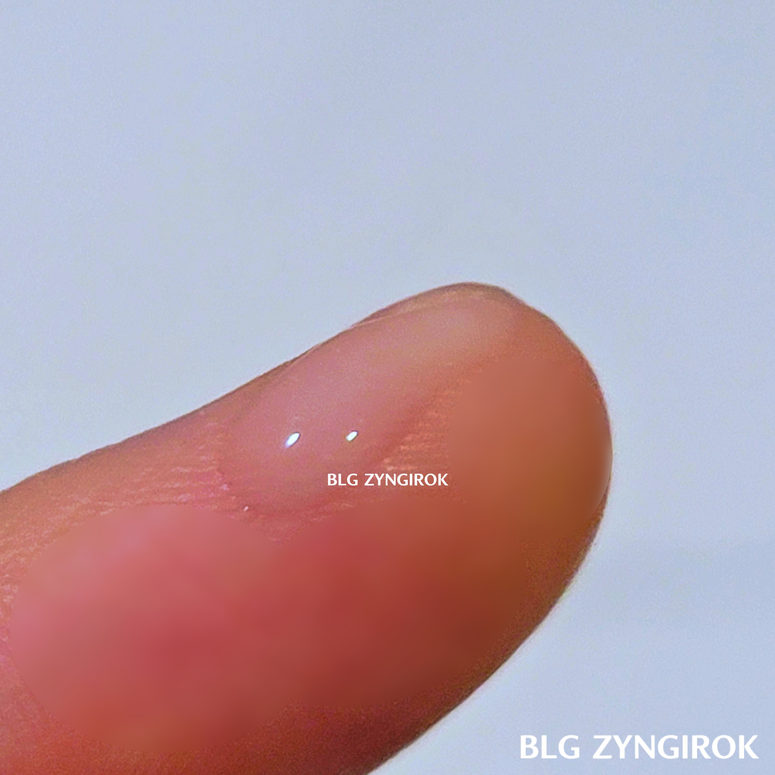 제로이드 루트힐 두피 보습제 - 손가락 위에 제로이드 제품을 짜낸 모습이다. 묽고 흰색 액체형이다.