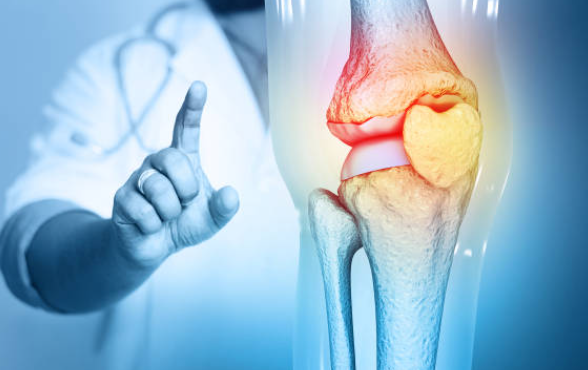 관절건강 콘드로이친