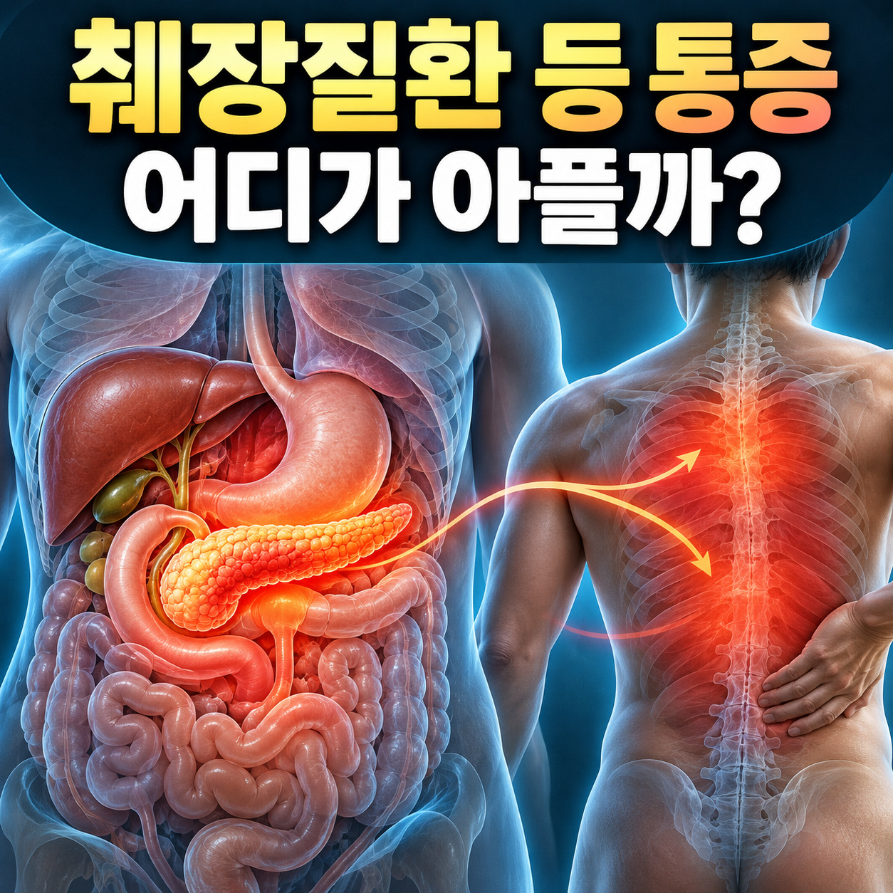 앞쪽 췌장 위치와 등으로 퍼질 수 있는 통증 영역을 보여주는 해부학 일러스트 대표 이미지