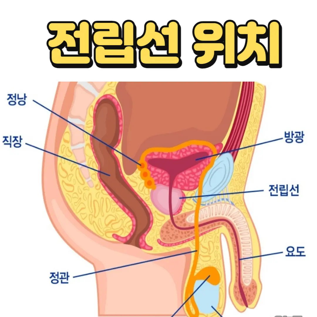 전립선위치