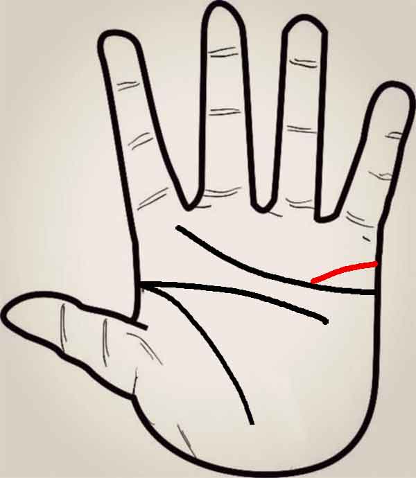 결합이 약한 손금