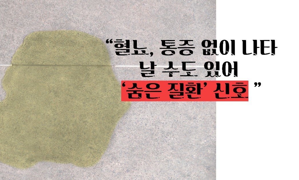 혈뇨가 나오는 이유