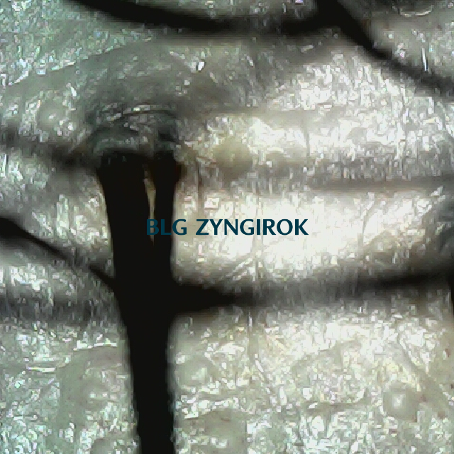 탈모 극복 프로젝트 - 뒷머리 두피모습이다.