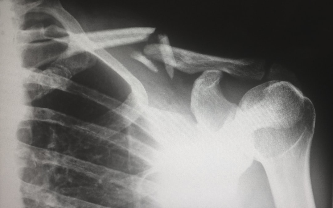 Shoulder.