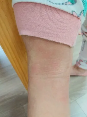 침구 진드기 햇볕 건조와 고온 살균 보관법_18