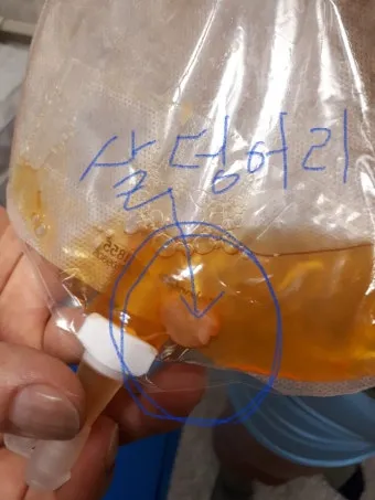 폐에 물이 차는 원인 증상 물참 관리 포인트에 대한 건강정보_19