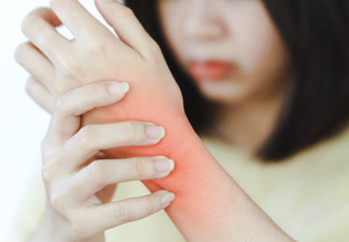 류마티스 관절염 초기증상 36