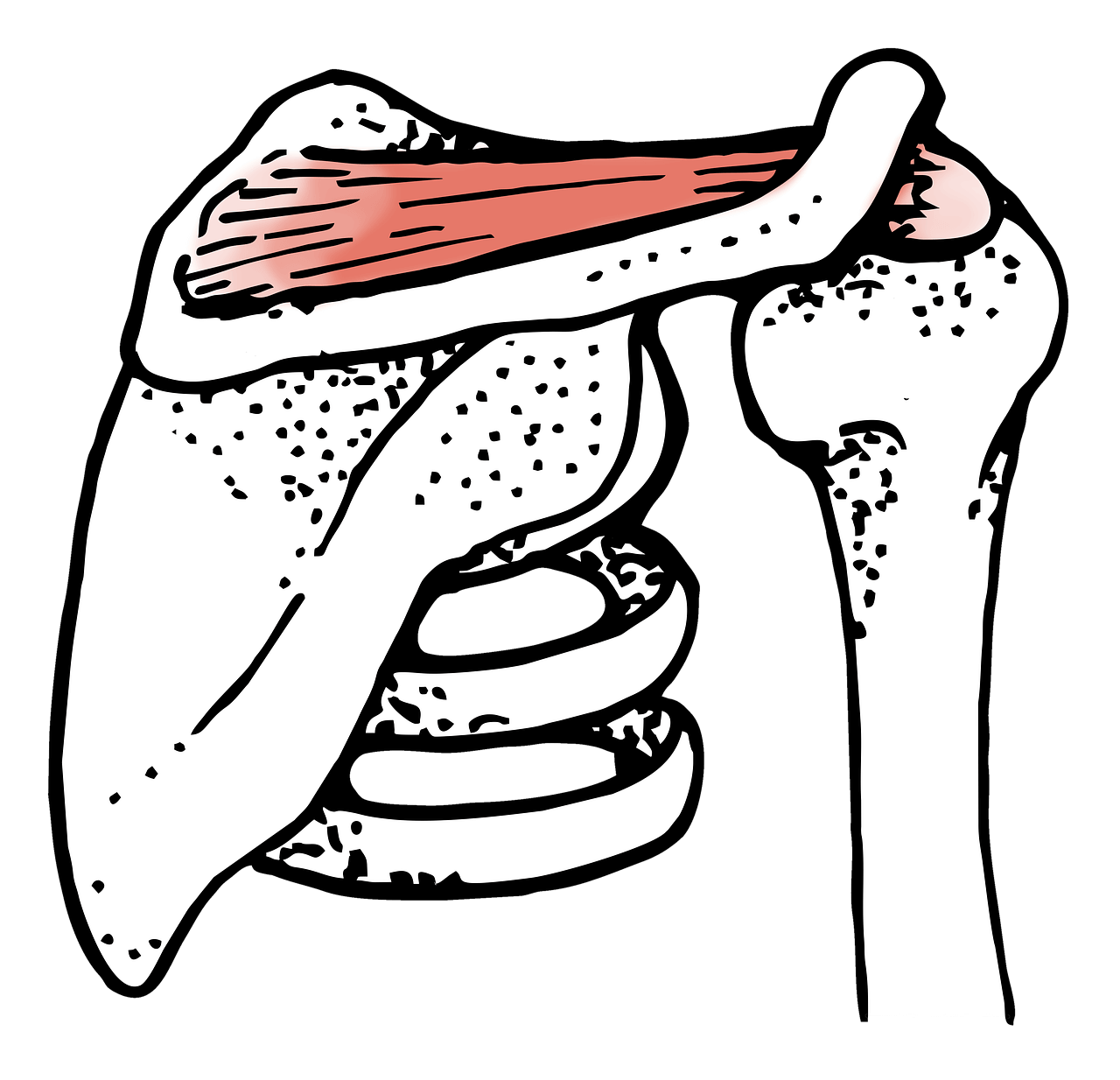 어깨 점액낭염 : 어깨 통증의 원인부터 치료까지