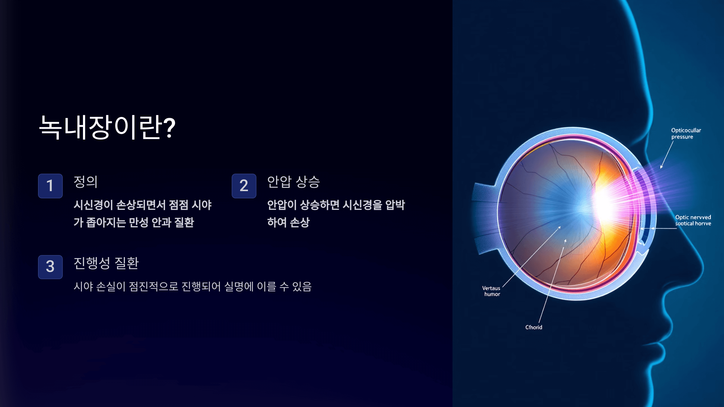 녹내장과 관련된 사진입니다.