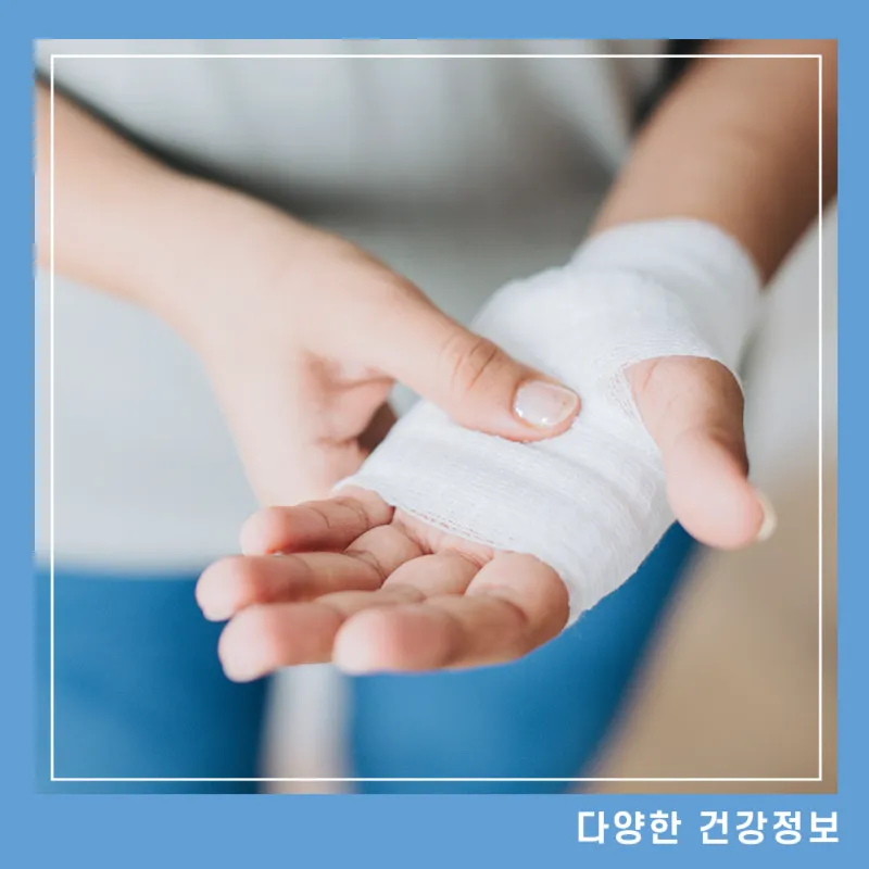 화상-물집-치료방법-대처