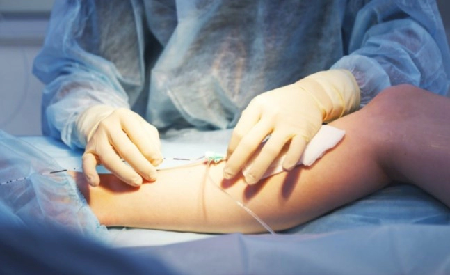 하지정맥류 베나실 치료법