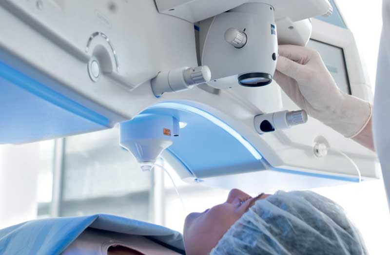 라식수술 검사 관련 이미지