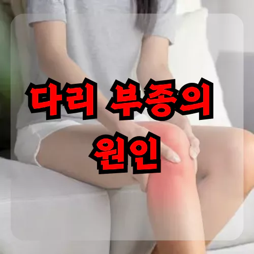 다리 부종의 원인
