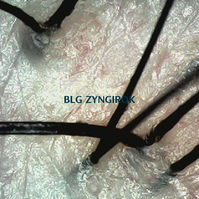 피나모아 복용 6주차 두피사진 - 뒷머리 모습이다.