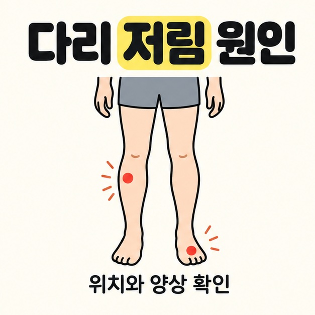 다리 저림 원인 제목 아래 양쪽 다리 그림의 한쪽 종아리와 반대쪽 발에 붉은 점을 표시하고 위치와 양상 확인을 안내한 대표 썸네일