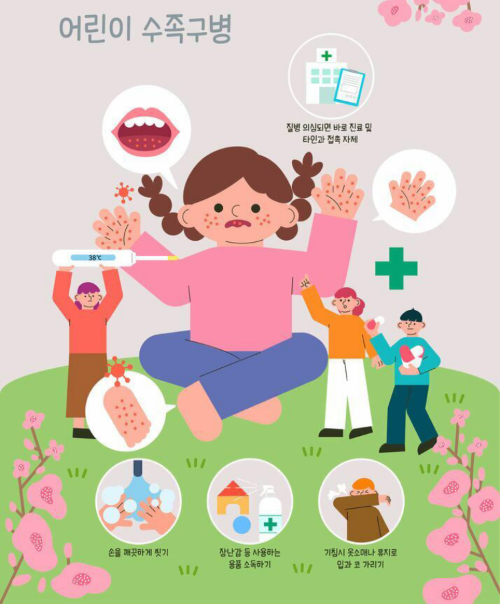 수족구병 치료