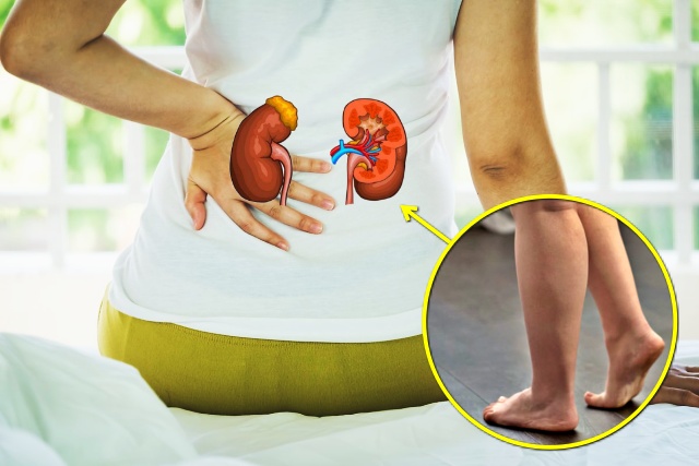 종아리 붓기 부종 콩팥이 안좋을때 증상, 건강 팁줌 매일꿀정보