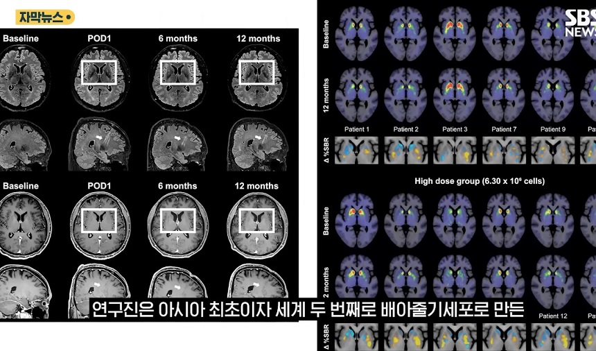 신경외과-장진우-교수