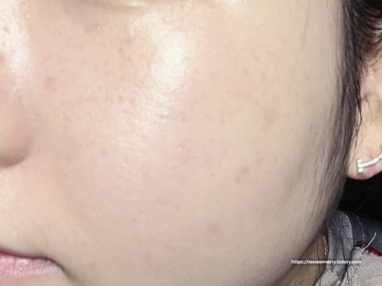 메이크업 후 좌측 볼 사진